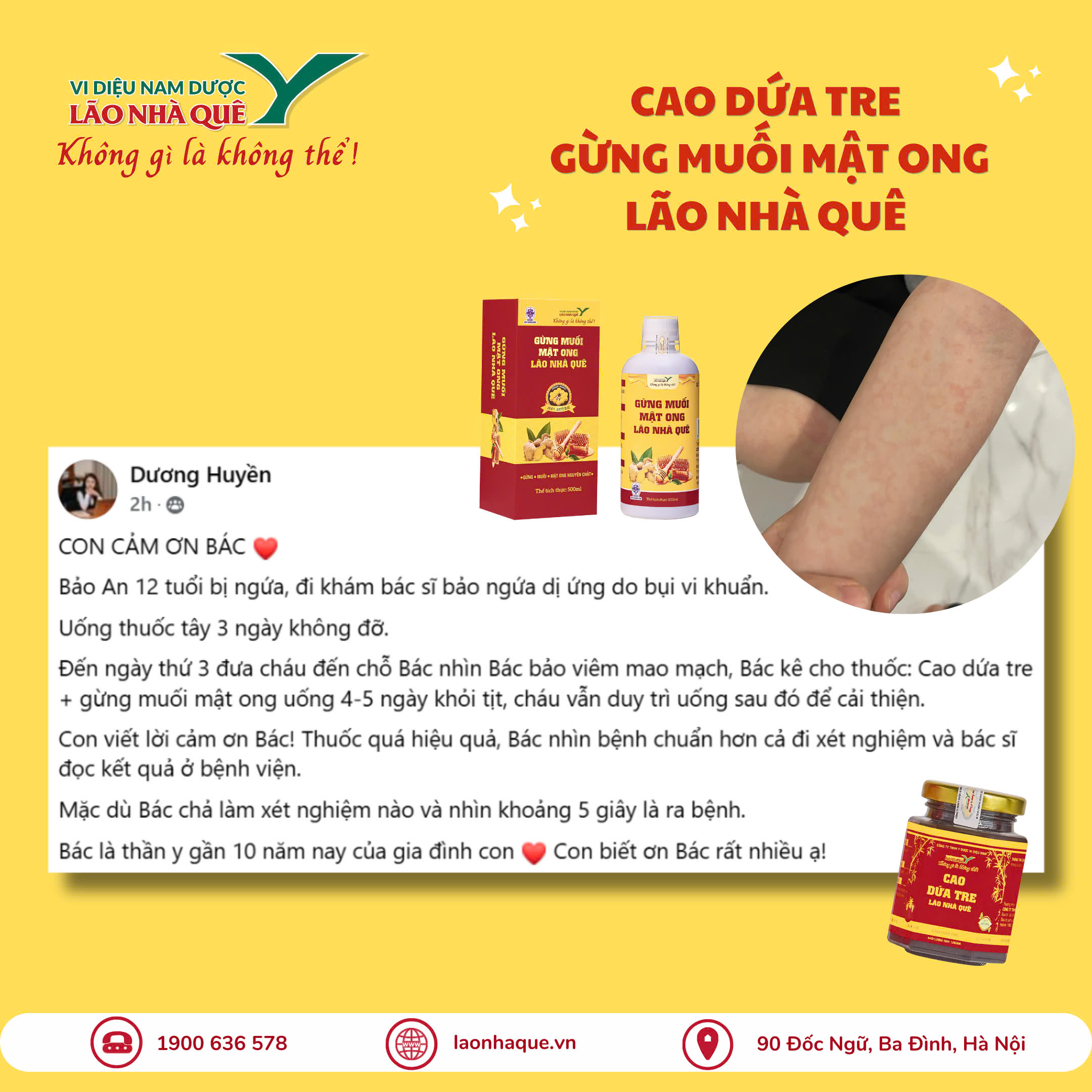 ĐI TÂY Y KHÔNG RA BỆNH, LÃO NHÌN CÁI BIẾT NGAY VIÊM MAO MẠCH