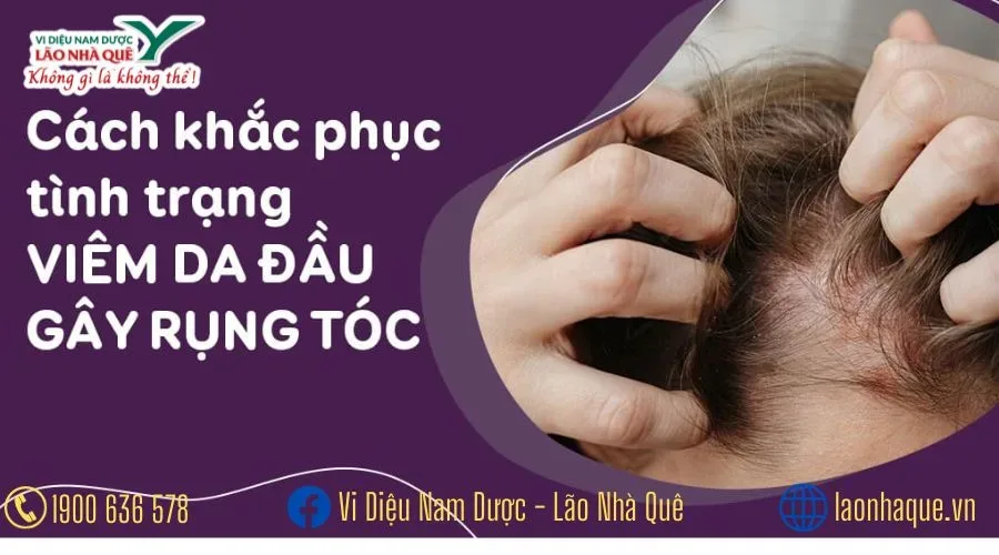 CÁC BỆNH VỀ DA ĐẦU TÓC RỤNG