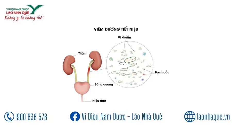CÁC BỆNH VỀ ĐƯỜNG TIỂU