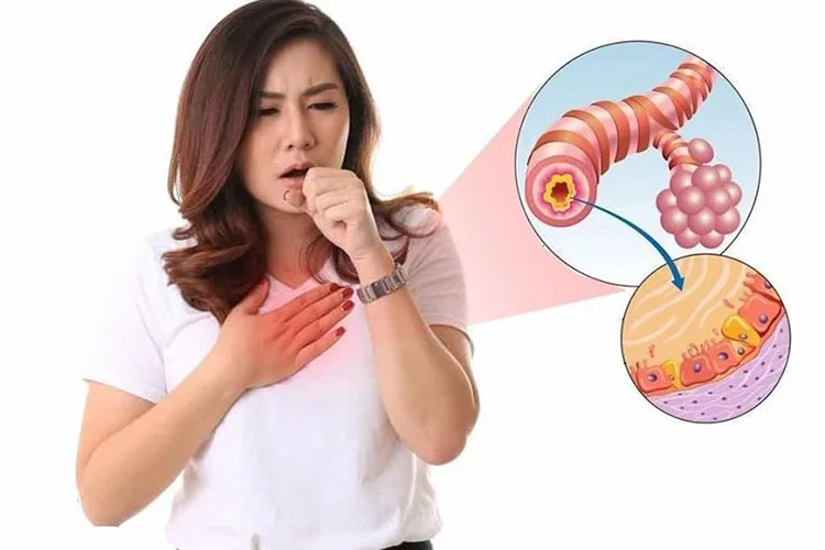 Hen suyễn – VIÊM PHỔI, VIÊM PHẾ QUẢN