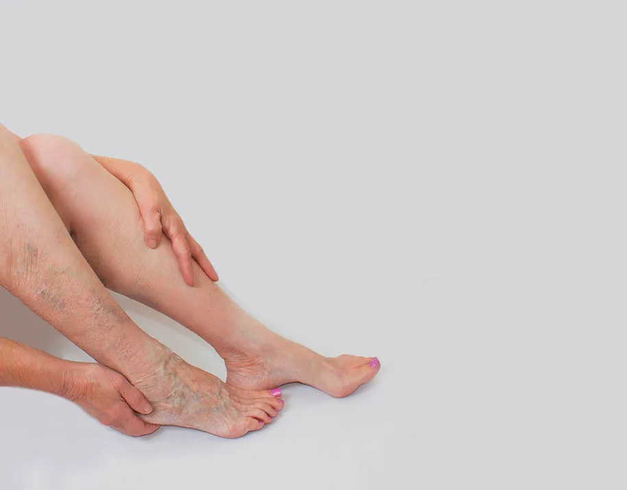 SUY GIÃN – HỎNG VAN TĨNH MẠCH – HUYẾT KHỐI